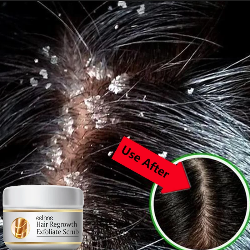 Scalp Scrub Exfoliant - Traitement Capillaire Antichute Rapide, Gommage Réparateur